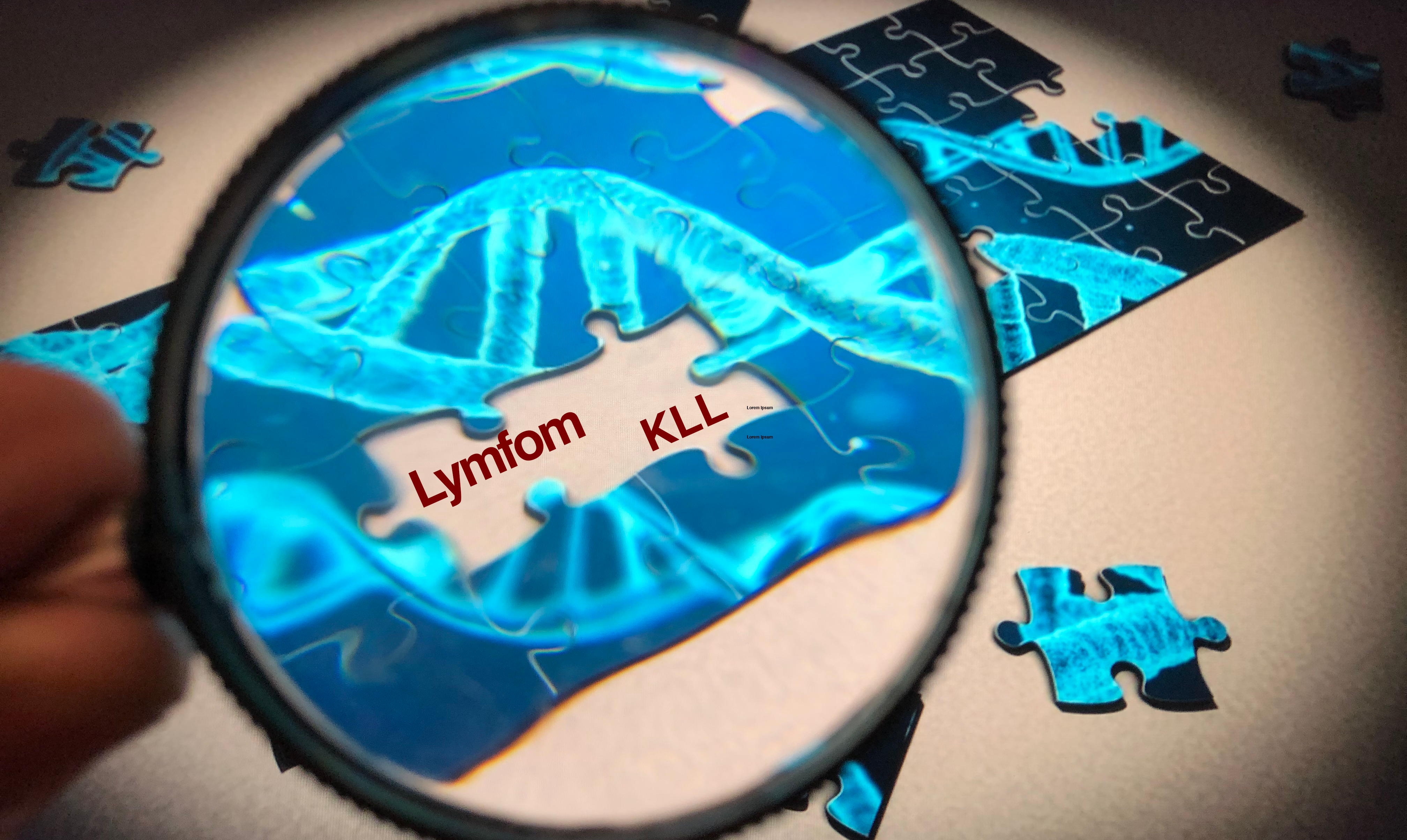 Pusselbitar Saknas Lymfom Och KLL Montage