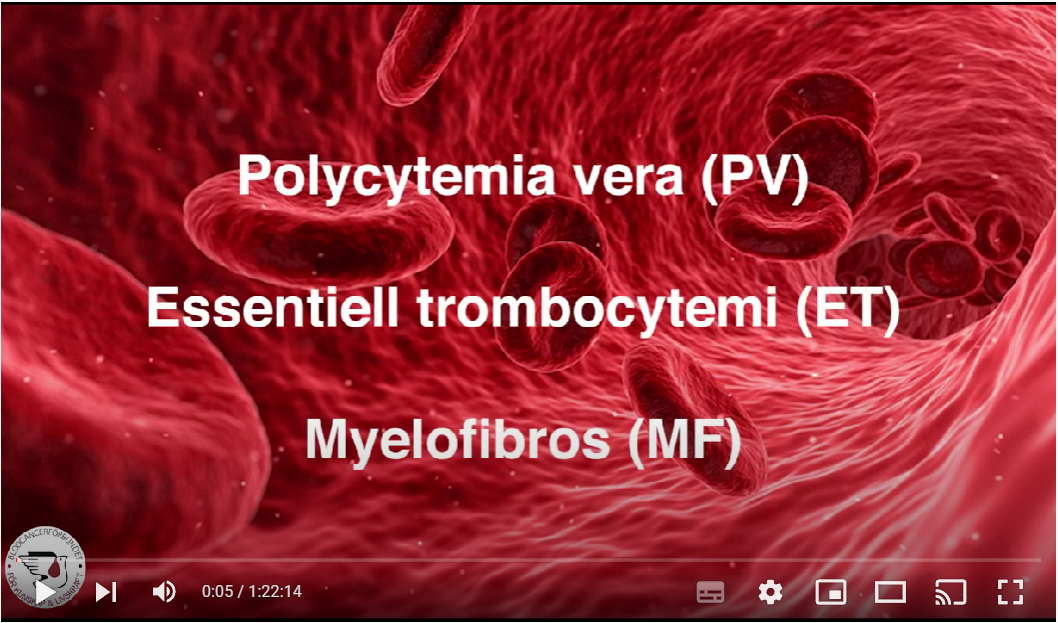 Startbild MPN Webbinarium 2022
